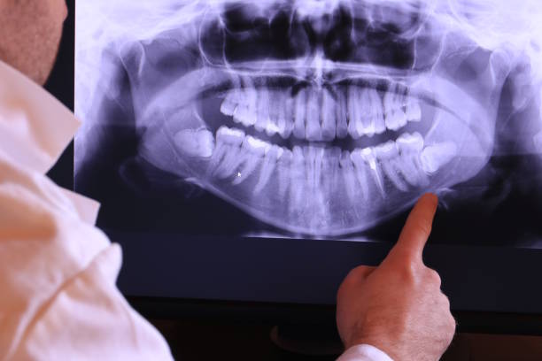 Best Emergency Denture Repair in Minnehaha, WA
