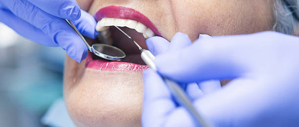 Best Emergency Dental Care for Broken or Chipped Teeth in Minnehaha, WA